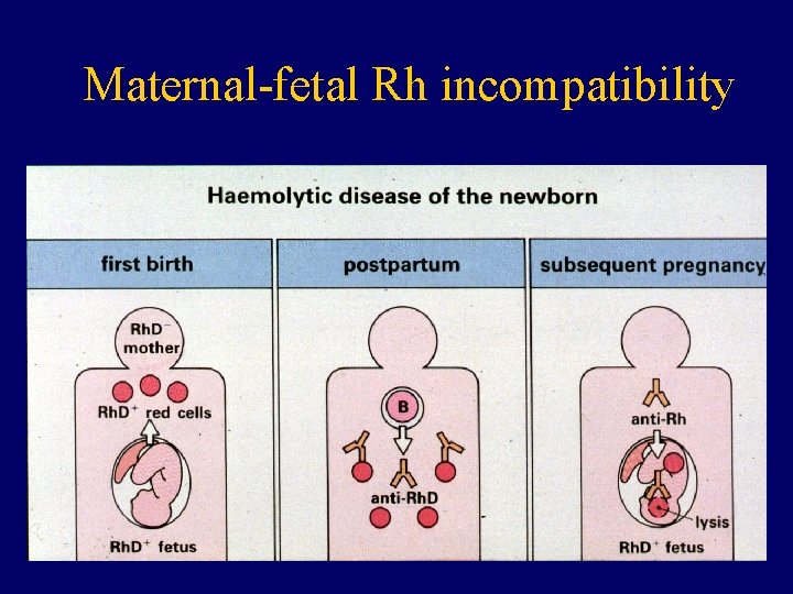 Maternal-fetal Rh incompatibility 