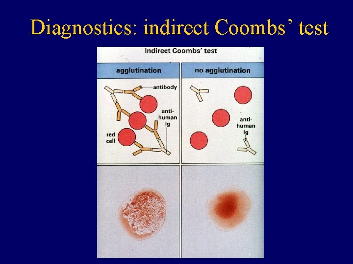 Diagnostics: indirect Coombs’ test 