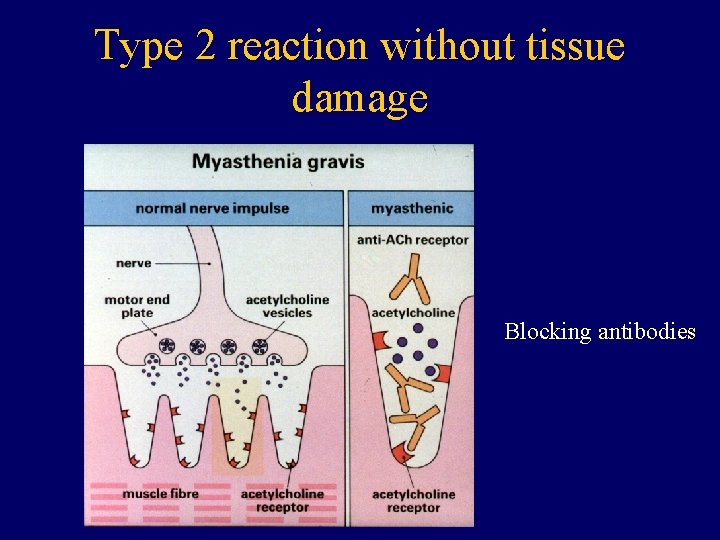 Type 2 reaction without tissue damage Blocking antibodies 