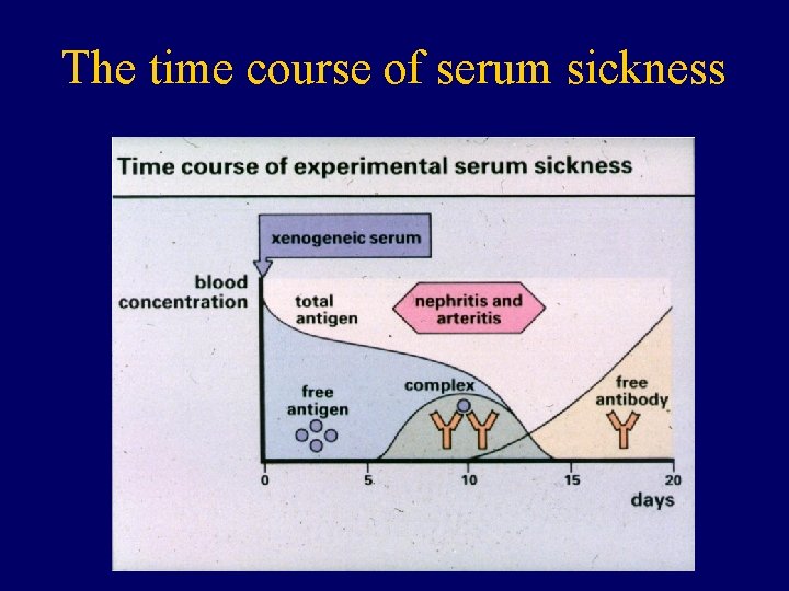 The time course of serum sickness 