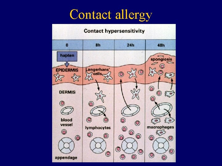 Contact allergy 