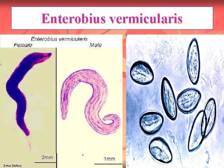 Enterobius vermicularis 