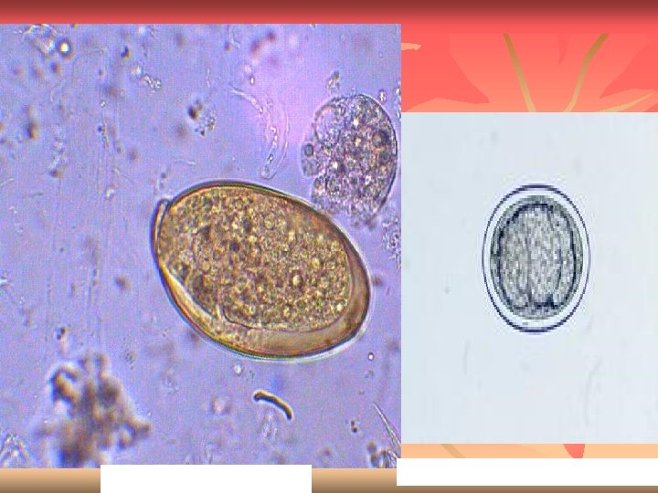 Fasciola hepatica egg Dicrocoelium dendriticum egg 
