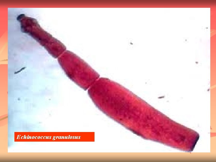 Echinococcus granulosus 
