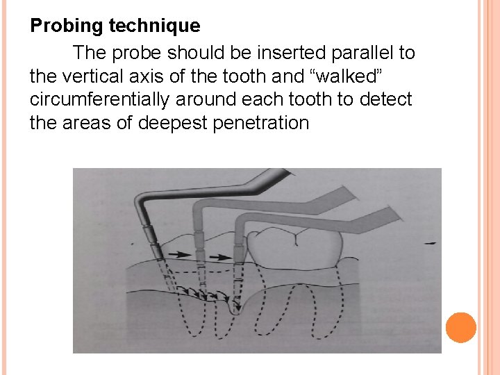 Probing technique The probe should be inserted parallel to the vertical axis of the