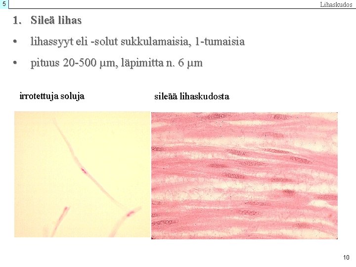 5 Lihaskudos 1. Sileä lihas • lihassyyt eli -solut sukkulamaisia, 1 -tumaisia • pituus