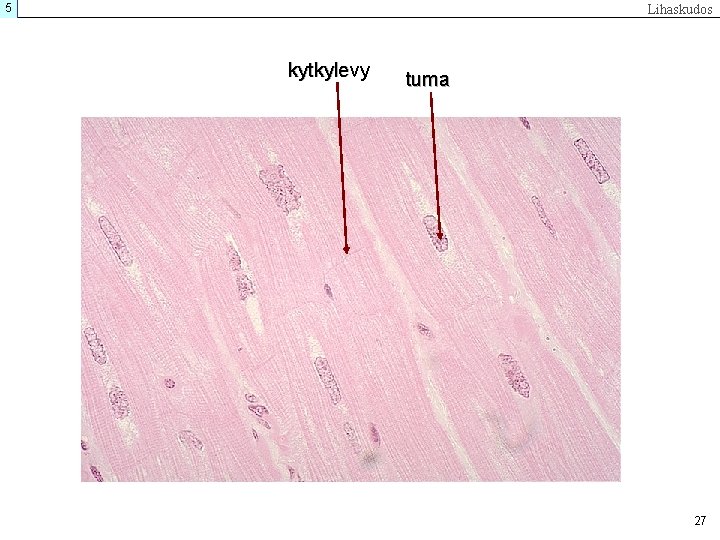 5 Lihaskudos kytkylevy tuma 27 