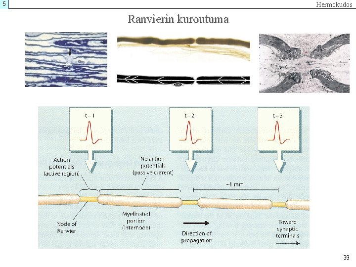 5 Hermokudos Ranvierin kuroutuma 39 