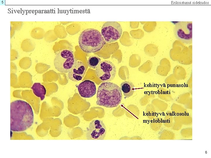 5 Erikoistunut sidekudos Sivelypreparaatti luuytimestä kehittyvä punasolu erytroblasti kehittyvä valkosolu myeloblasti 6 