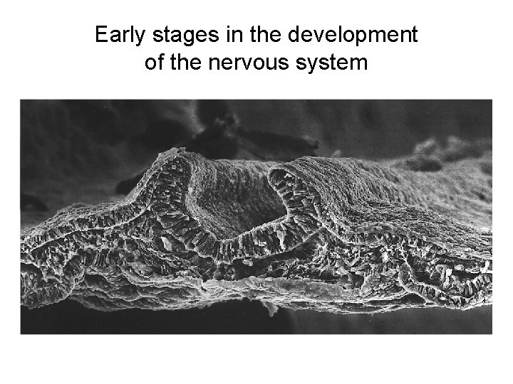Early stages in the development of the nervous system 
