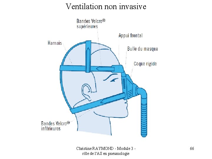 Ventilation non invasive Christine RAYMOND - Module 3 rôle de l'AS en pneumologie 66