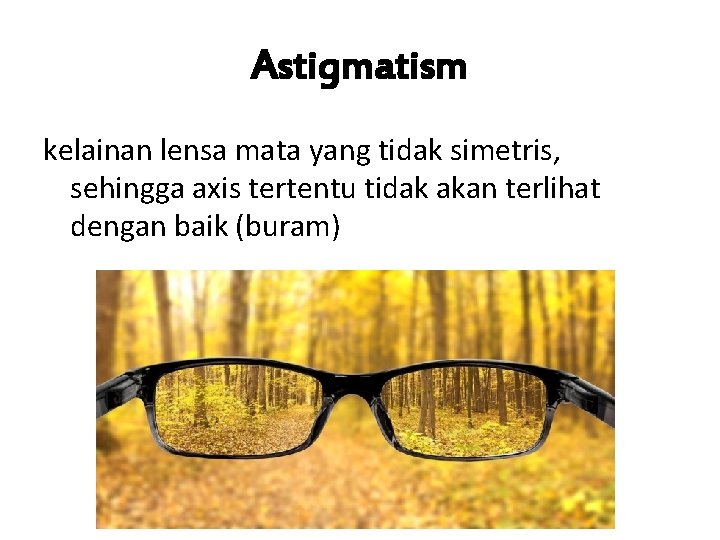 Astigmatism kelainan lensa mata yang tidak simetris, sehingga axis tertentu tidak akan terlihat dengan