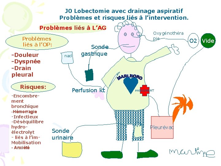  J 0 Lobectomie avec drainage aspiratif Problèmes et risques liés à l’intervention. Problèmes