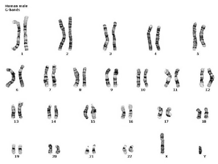 Karyotype n n A picture of all the chromosomes. It is used to look