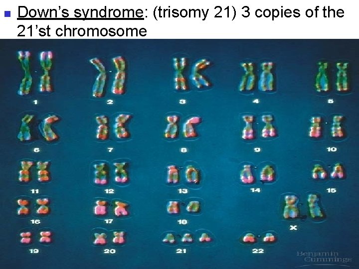 n Down’s syndrome: (trisomy 21) 3 copies of the 21’st chromosome 