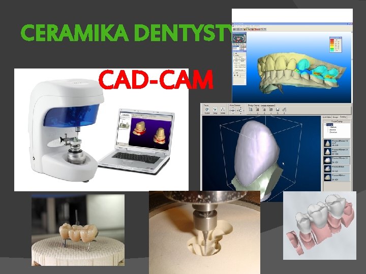 CERAMIKA DENTYSTYCZNA CAD-CAM 