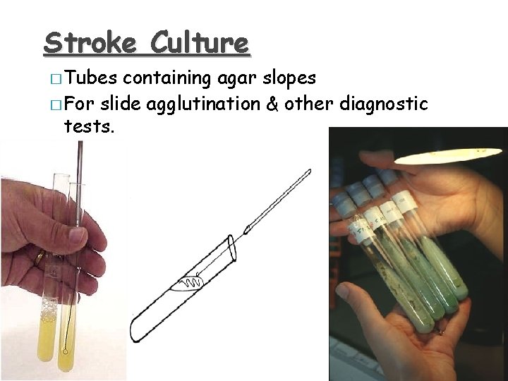 Stroke Culture � Tubes containing agar slopes � For slide agglutination & other diagnostic