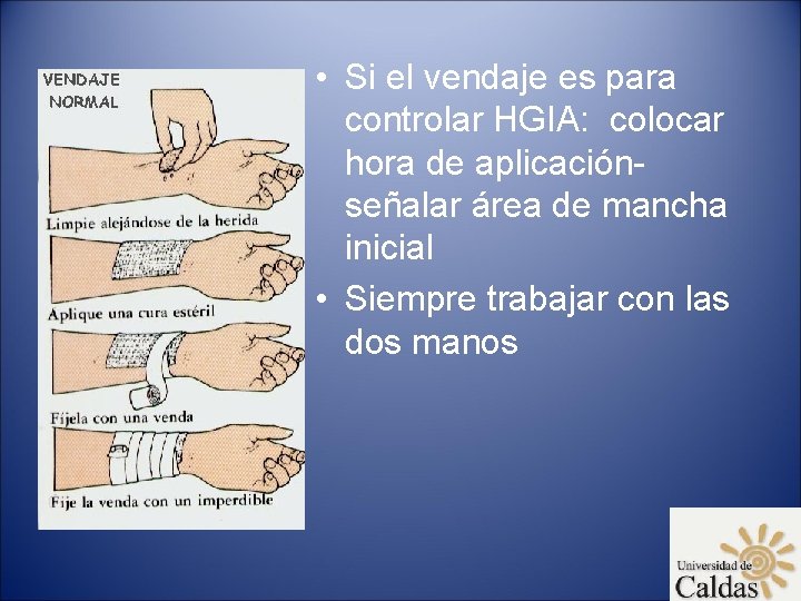  • Si el vendaje es para controlar HGIA: colocar hora de aplicaciónseñalar área