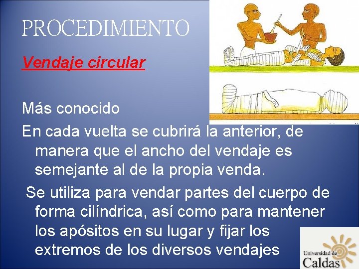 PROCEDIMIENTO Vendaje circular Más conocido En cada vuelta se cubrirá la anterior, de manera