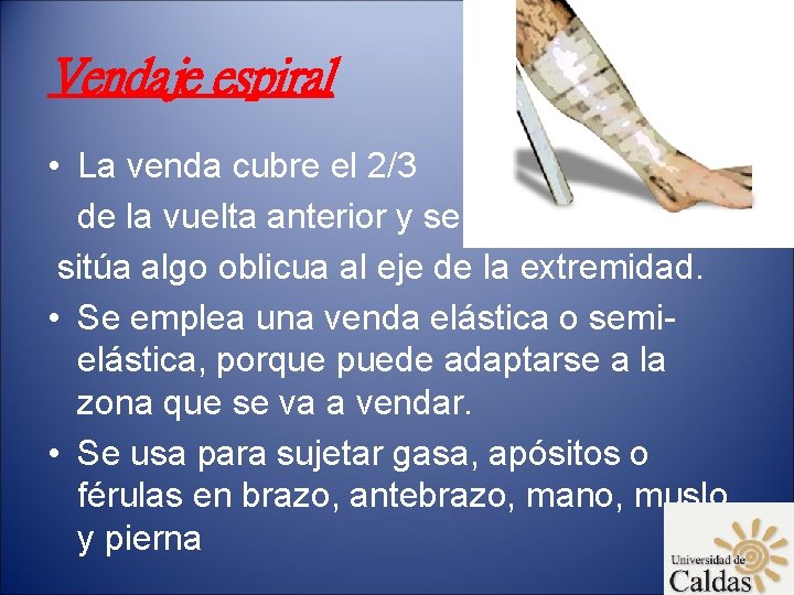 Vendaje espiral • La venda cubre el 2/3 de la vuelta anterior y se