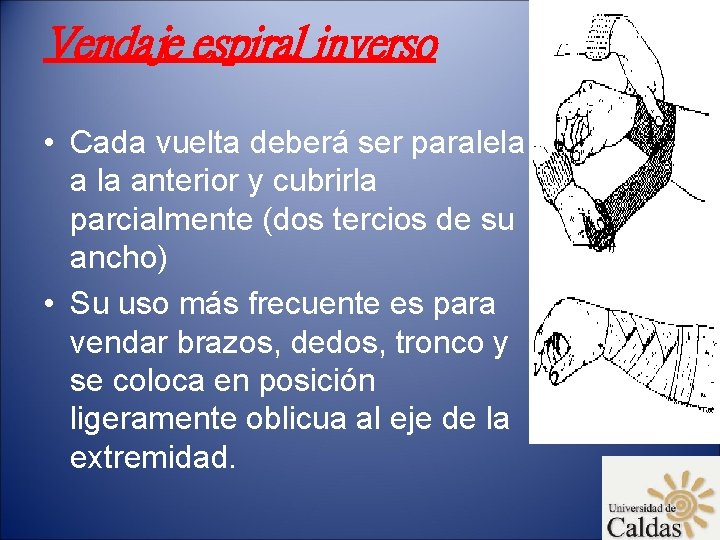 Vendaje espiral inverso • Cada vuelta deberá ser paralela anterior y cubrirla parcialmente (dos