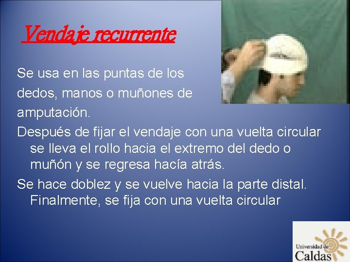 Vendaje recurrente Se usa en las puntas de los dedos, manos o muñones de