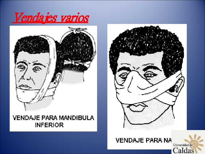 Vendajes varios 