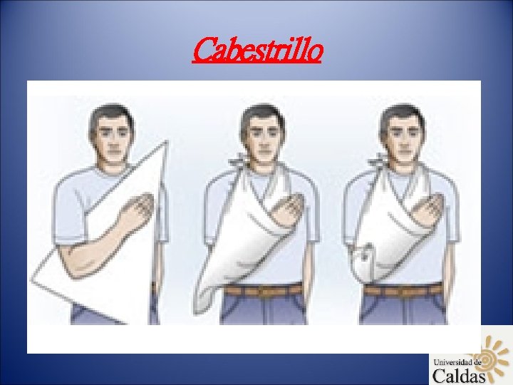 Cabestrillo 