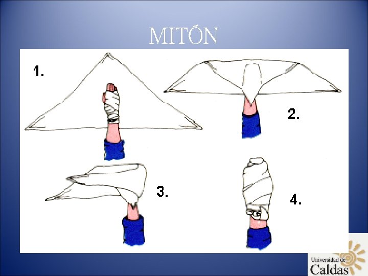 MITÓN 