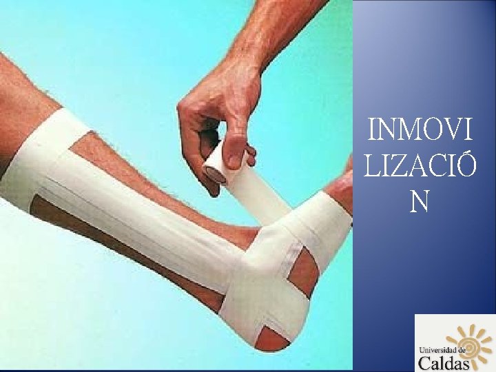 INMOVI LIZACIÓ N 