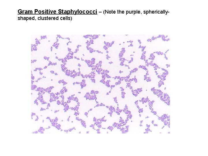 Gram Positive Staphylococci – (Note the purple, sphericallyshaped, clustered cells) 