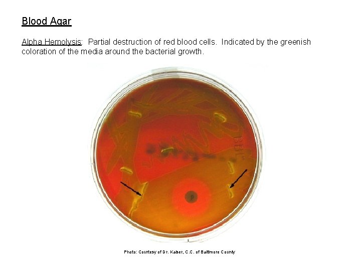 Blood Agar Alpha Hemolysis: Partial destruction of red blood cells. Indicated by the greenish