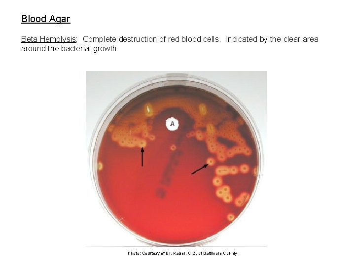 Blood Agar Beta Hemolysis: Complete destruction of red blood cells. Indicated by the clear