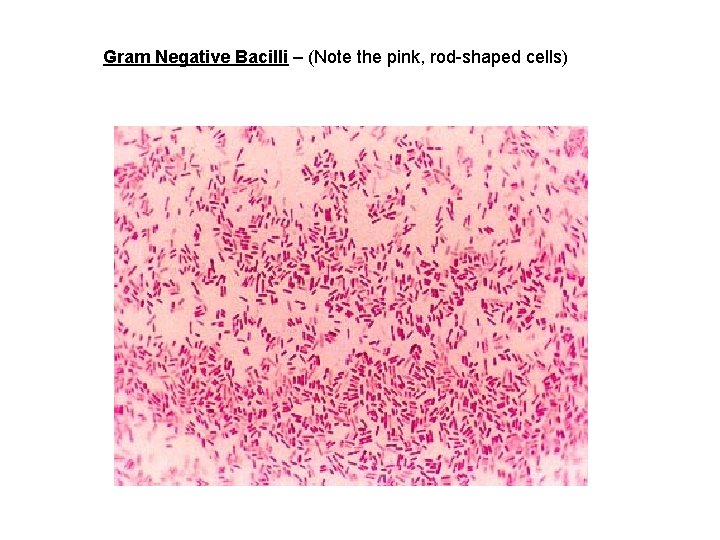 Gram Negative Bacilli – (Note the pink, rod-shaped cells) 