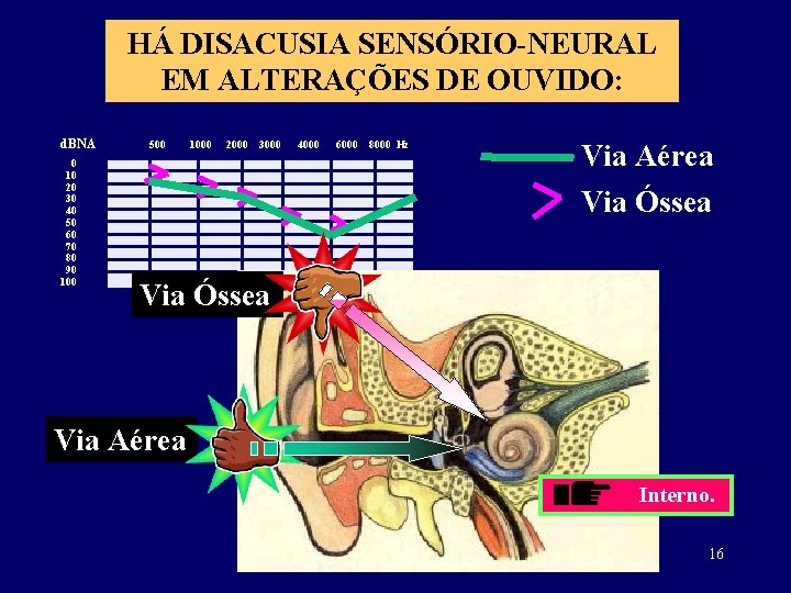 HÁ DISACUSIA SENSÓRIO-NEURAL EM ALTERAÇÕES DE OUVIDO: d. BNA 0 10 20 30 40