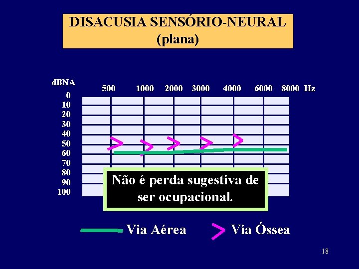 DISACUSIA SENSÓRIO-NEURAL (plana) d. BNA 0 10 20 30 40 50 60 70 80