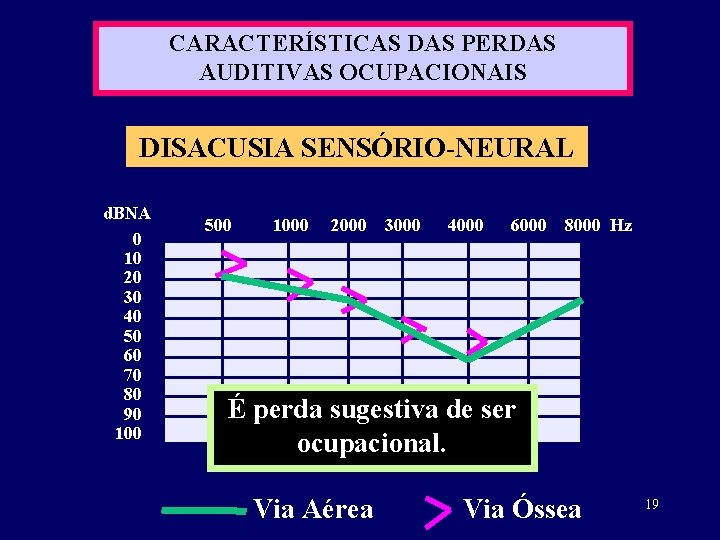 CARACTERÍSTICAS DAS PERDAS AUDITIVAS OCUPACIONAIS DISACUSIA SENSÓRIO-NEURAL d. BNA 0 10 20 30 40
