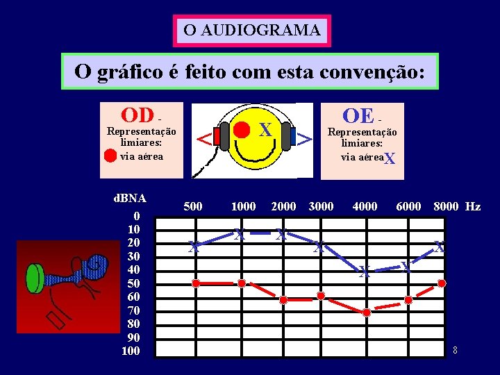 O AUDIOGRAMA O gráfico é feito com esta convenção: OD - Representação limiares: via