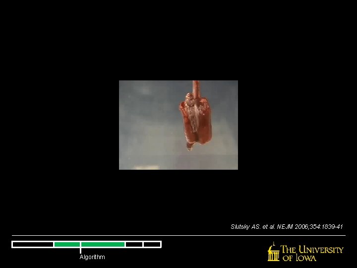 Slutsky AS. et al. NEJM 2006; 354: 1839 -41 Algorithm Slutsky AS. et al. NEJM 2006; 354: 1839 -41 Algorithm