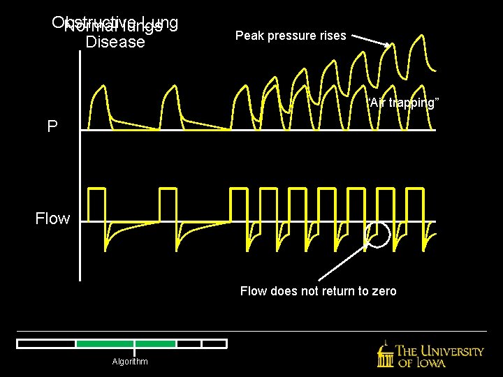 Obstructive Lung Normal lungs Disease Peak pressure rises “Air trapping” P Flow does not Obstructive Lung Normal lungs Disease Peak pressure rises “Air trapping” P Flow does not