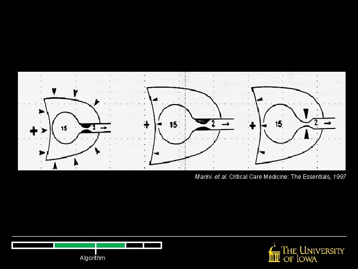 Marini. et al. Critical Care Medicine: The Essentials, 1997 Algorithm Marini. et al. Critical Care Medicine: The Essentials, 1997 Algorithm