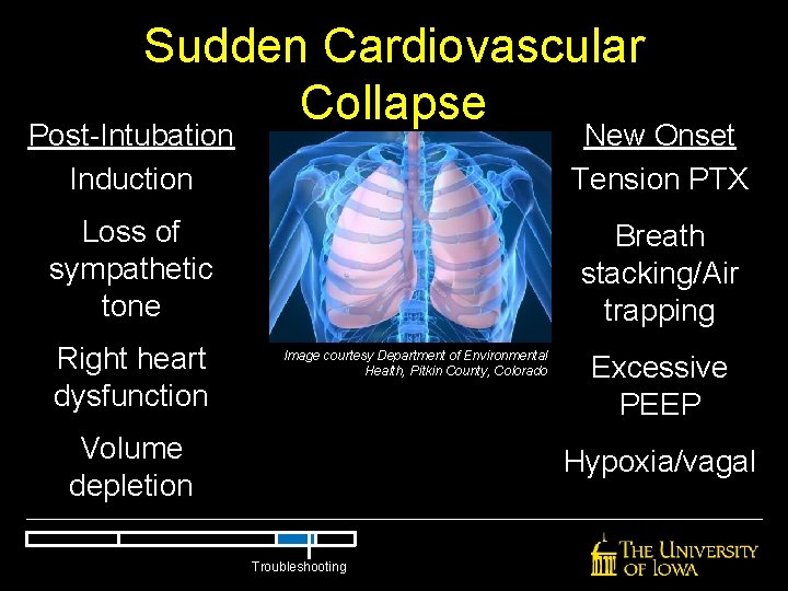 Sudden Cardiovascular Collapse Post-Intubation Induction New Onset Tension PTX Loss of sympathetic tone Breath Sudden Cardiovascular Collapse Post-Intubation Induction New Onset Tension PTX Loss of sympathetic tone Breath