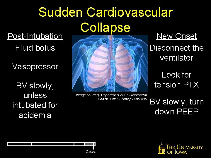 Sudden Cardiovascular Collapse New Onset Disconnect the ventilator Post-Intubation Fluid bolus Vasopressor BV slowly, Sudden Cardiovascular Collapse New Onset Disconnect the ventilator Post-Intubation Fluid bolus Vasopressor BV slowly,