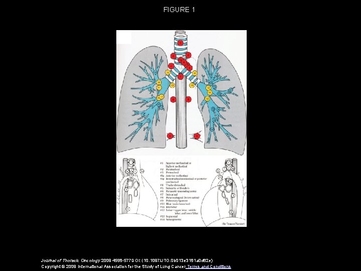 FIGURE 1 Journal of Thoracic Oncology 2009 4568 -577 DOI: (10. 1097/JTO. 0 b