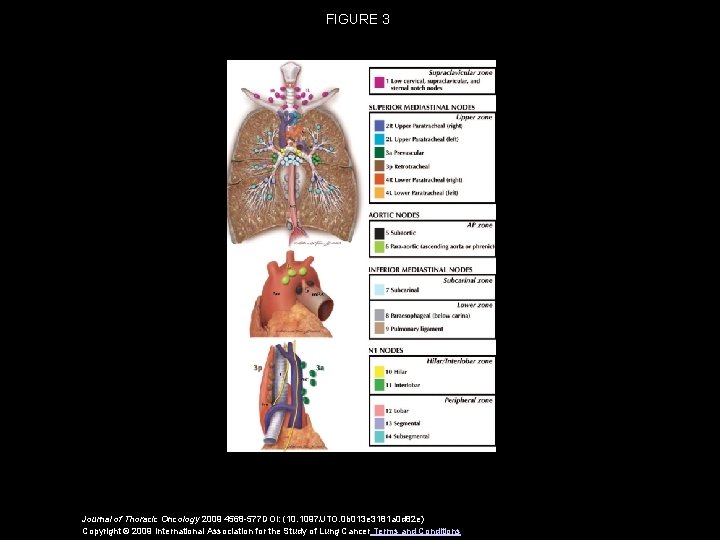 FIGURE 3 Journal of Thoracic Oncology 2009 4568 -577 DOI: (10. 1097/JTO. 0 b