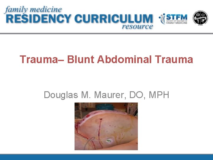 Trauma– Blunt Abdominal Trauma Douglas M. Maurer, DO, MPH 