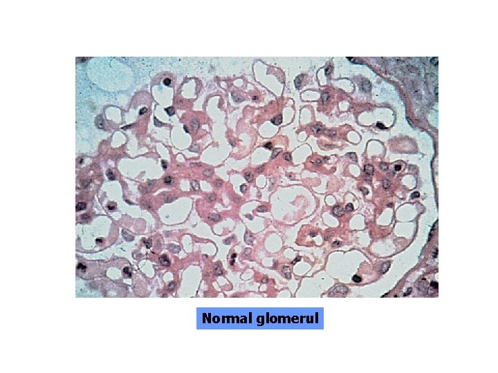 Normal glomerul 