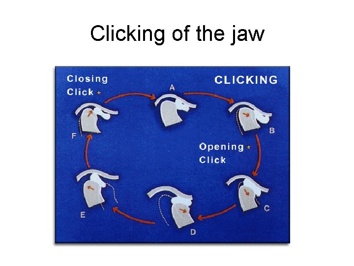 Clicking of the jaw 