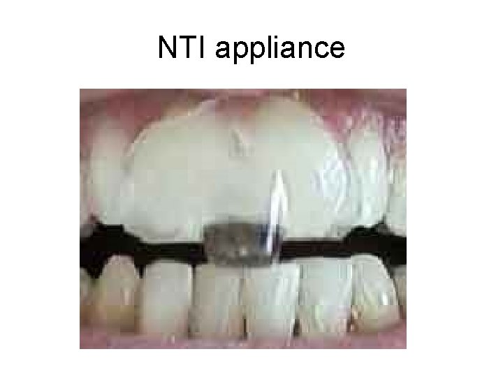 NTI appliance 