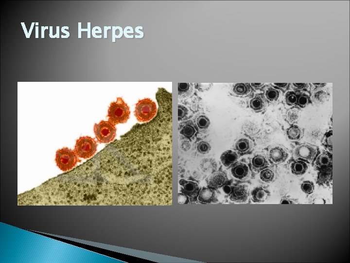 Virus Herpes 